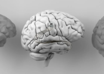 China’s NEO Brain Chip Becomes First Commercially Approved Invasive BCI