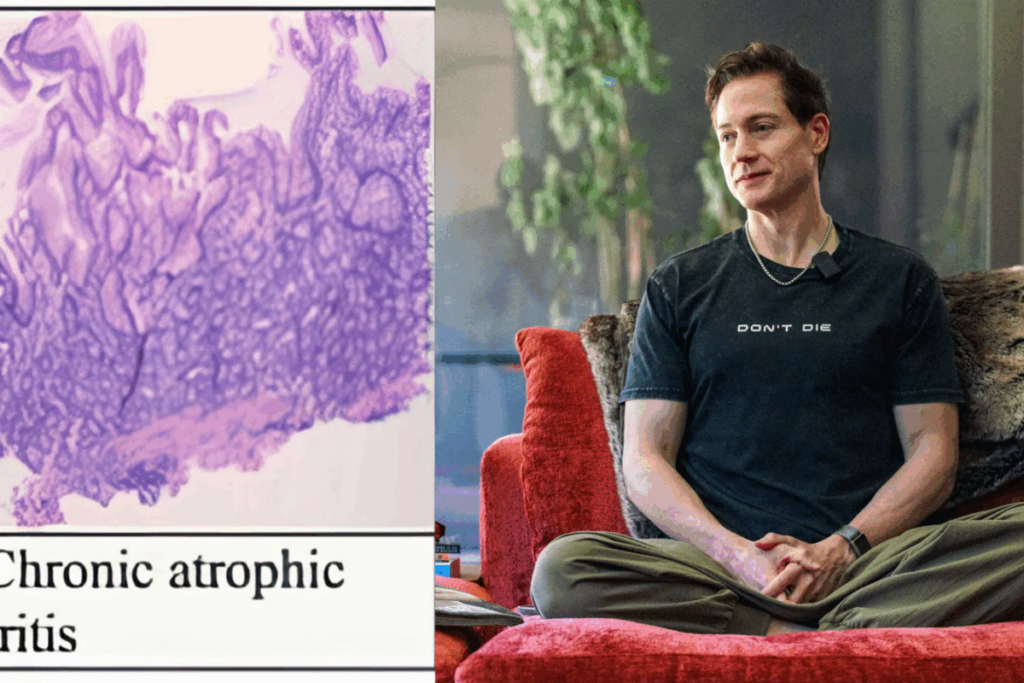 Bryan Johnson To Reset His Cells Using AI After Being Diagnosed With Autoimmune Gastritis