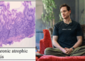 Bryan Johnson To Reset His Cells Using AI After Being Diagnosed With Autoimmune Gastritis