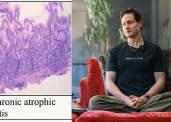 Bryan Johnson To Reset His Cells Using AI After Being Diagnosed With Autoimmune Gastritis