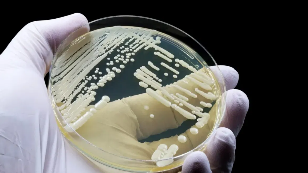 Scientists have discovered how the drug-resistant fungus Candida auris hides in hair follicles, helping it evade the immune system and persist on the skin.