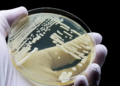 Drug-Resistant Candida Auris Fungus Found in 23 US States. Here’s How It Hides In Hair Follicles