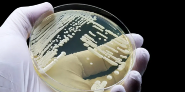 Drug-Resistant Candida Auris Fungus Found in 23 US States. Here’s How It Hides In Hair Follicles