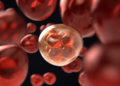 Microbubbles For Liver Cancer: How a Tiny Technology Helped Shrink Advanced Tumors in a New Study