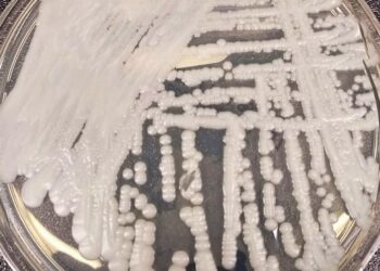 White colonies of the fungus Candida auris growing on a culture plate in a laboratory