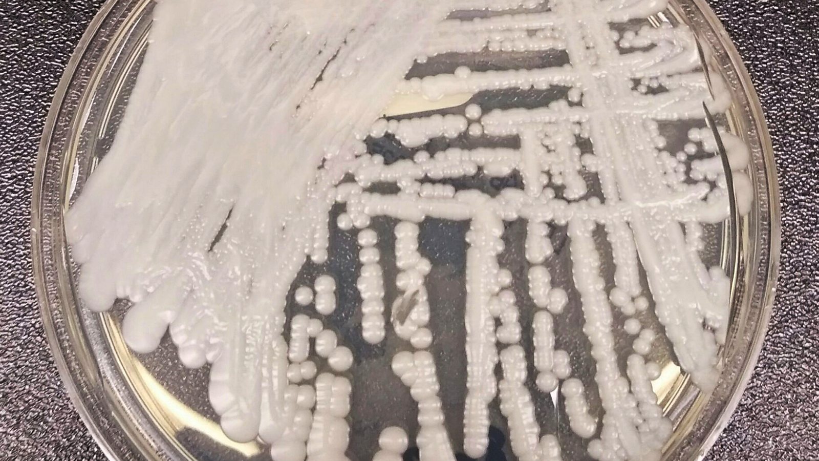 White colonies of the fungus Candida auris growing on a culture plate in a laboratory
