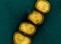 Colorized electron micrograph of influenza A H1N1 virus particles, shown in yellow