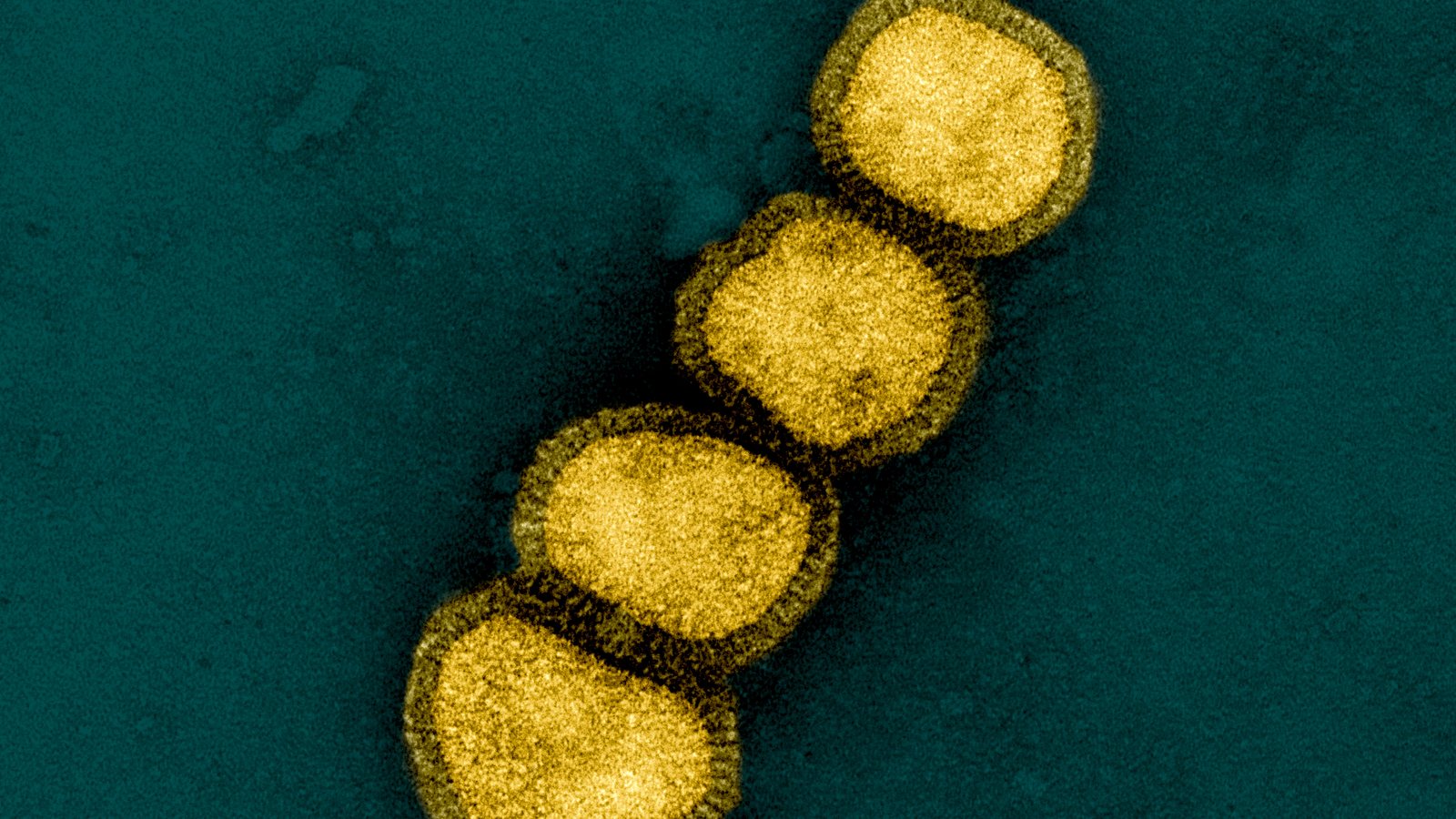 Colorized electron micrograph of influenza A H1N1 virus particles, shown in yellow