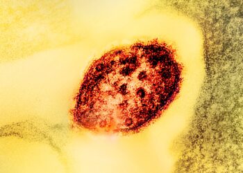 Colorized electron micrograph of a single measles virus particle, shown in dark red against a yellow background