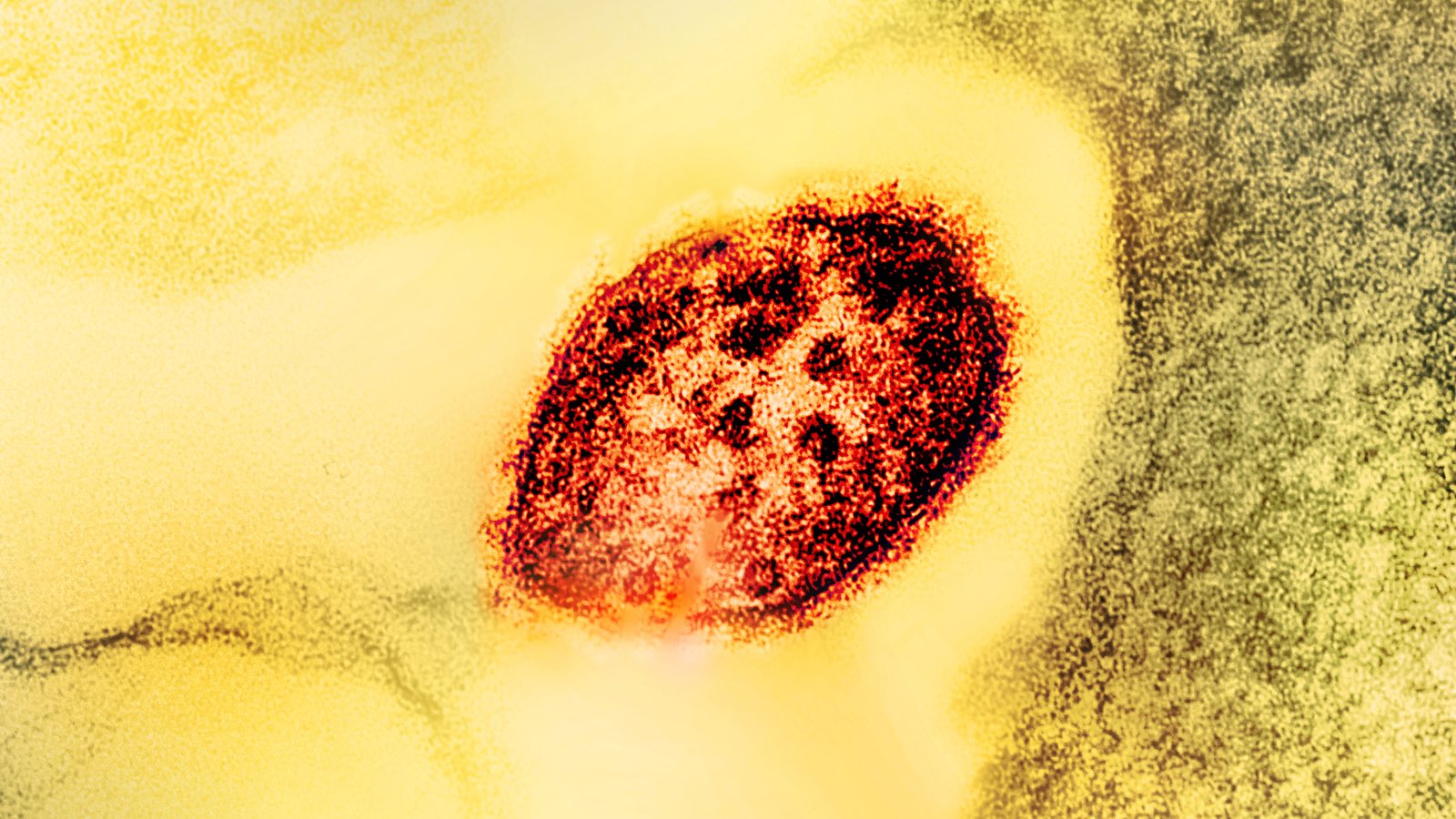 Colorized electron micrograph of a single measles virus particle, shown in dark red against a yellow background