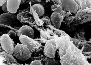 Electron micrograph of Yersinia pestis, the bacterium that causes plague